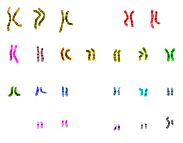 Human karyotype